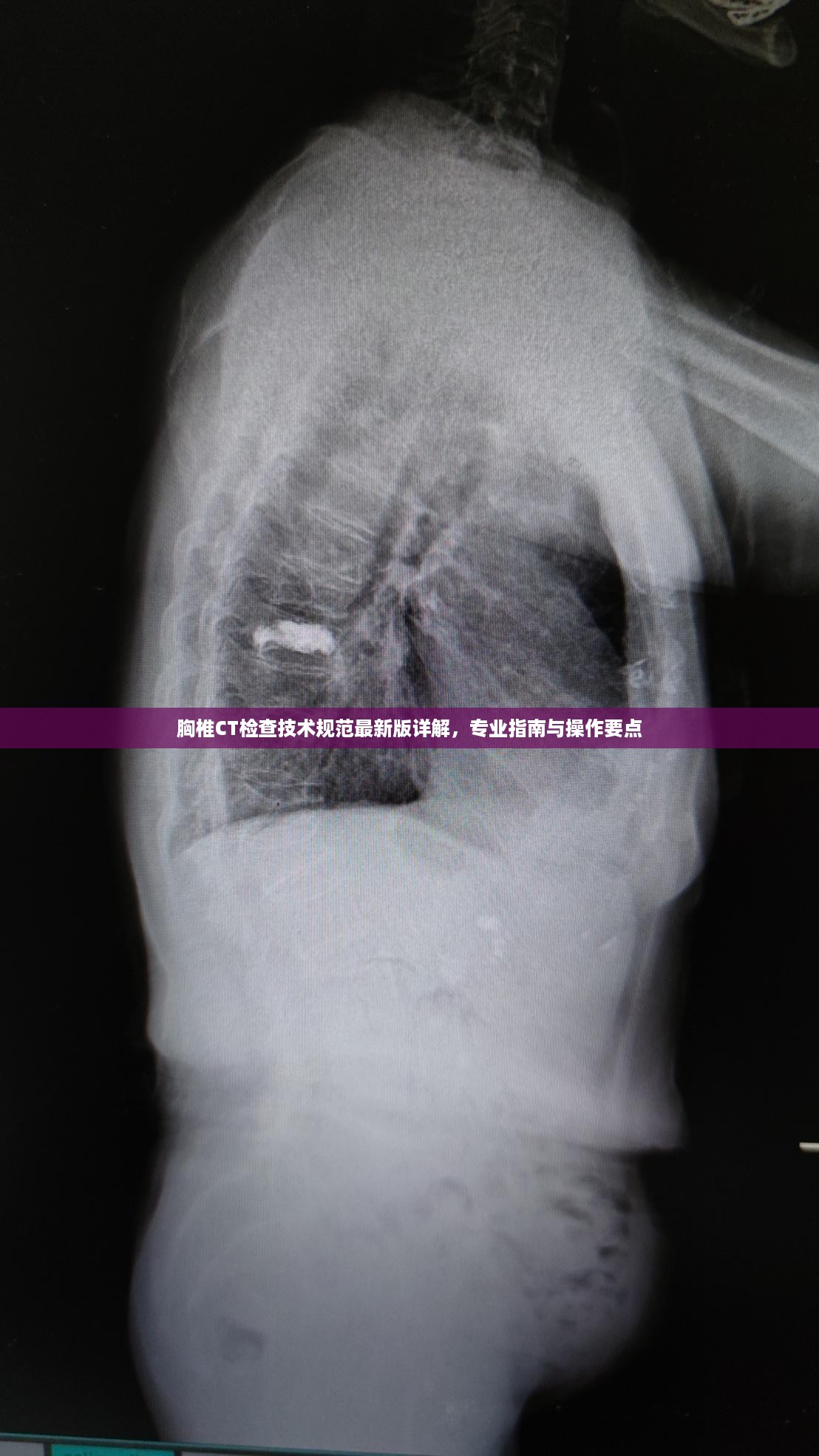 胸椎CT检查技术规范最新版详解，专业指南与操作要点